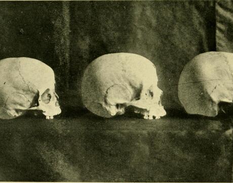 Three skulls are lined in a row.